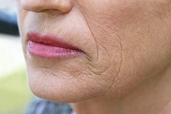 Aging Facial Skin Menopause