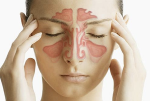 Image of woman who is experiencing congestion